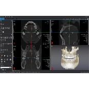 [3D Industrial] Dentiq3D