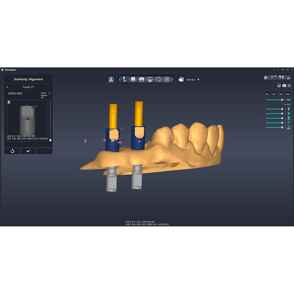 [3D Industrial] DentiqAbut