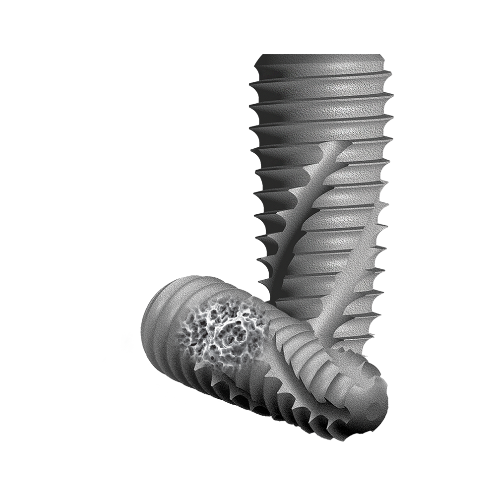 COWELL INNO Implant System